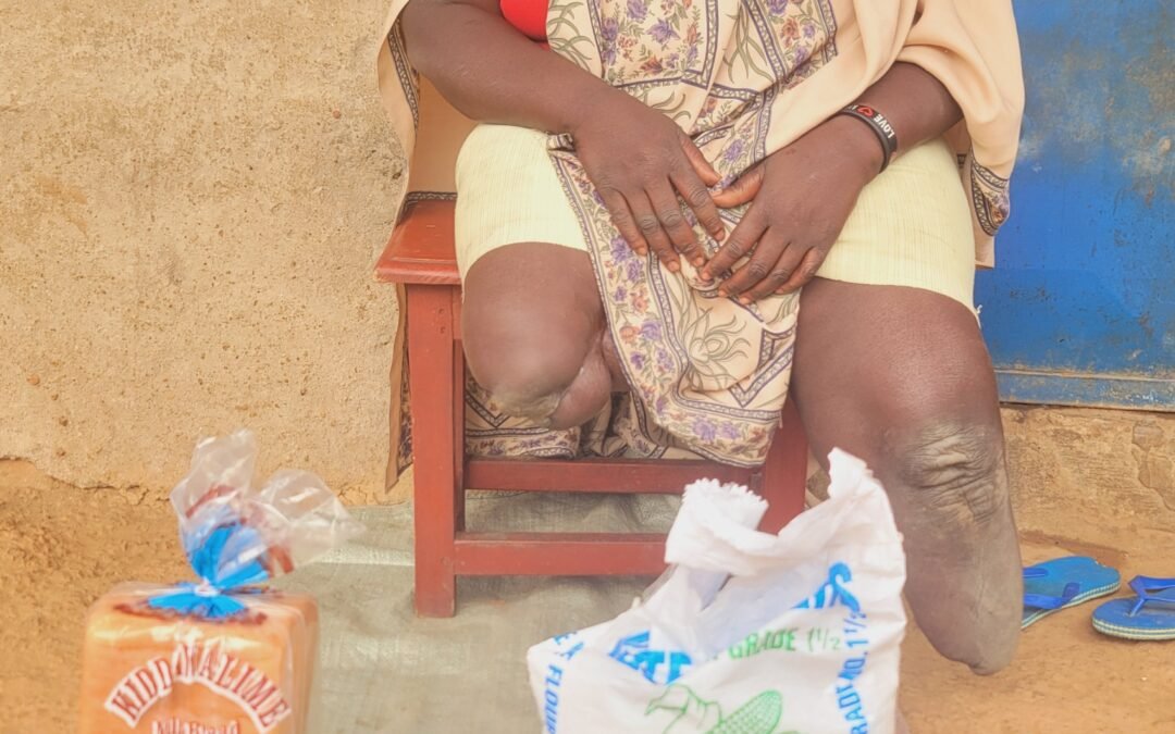 Food Package to a Crippled Woman 🇺🇬